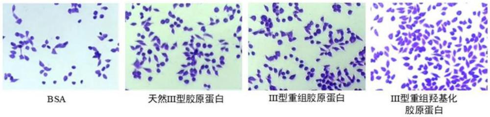 具有細(xì)胞粘附性的重組羥基化人Ⅲ型膠原蛋白及其制備方法和應(yīng)用