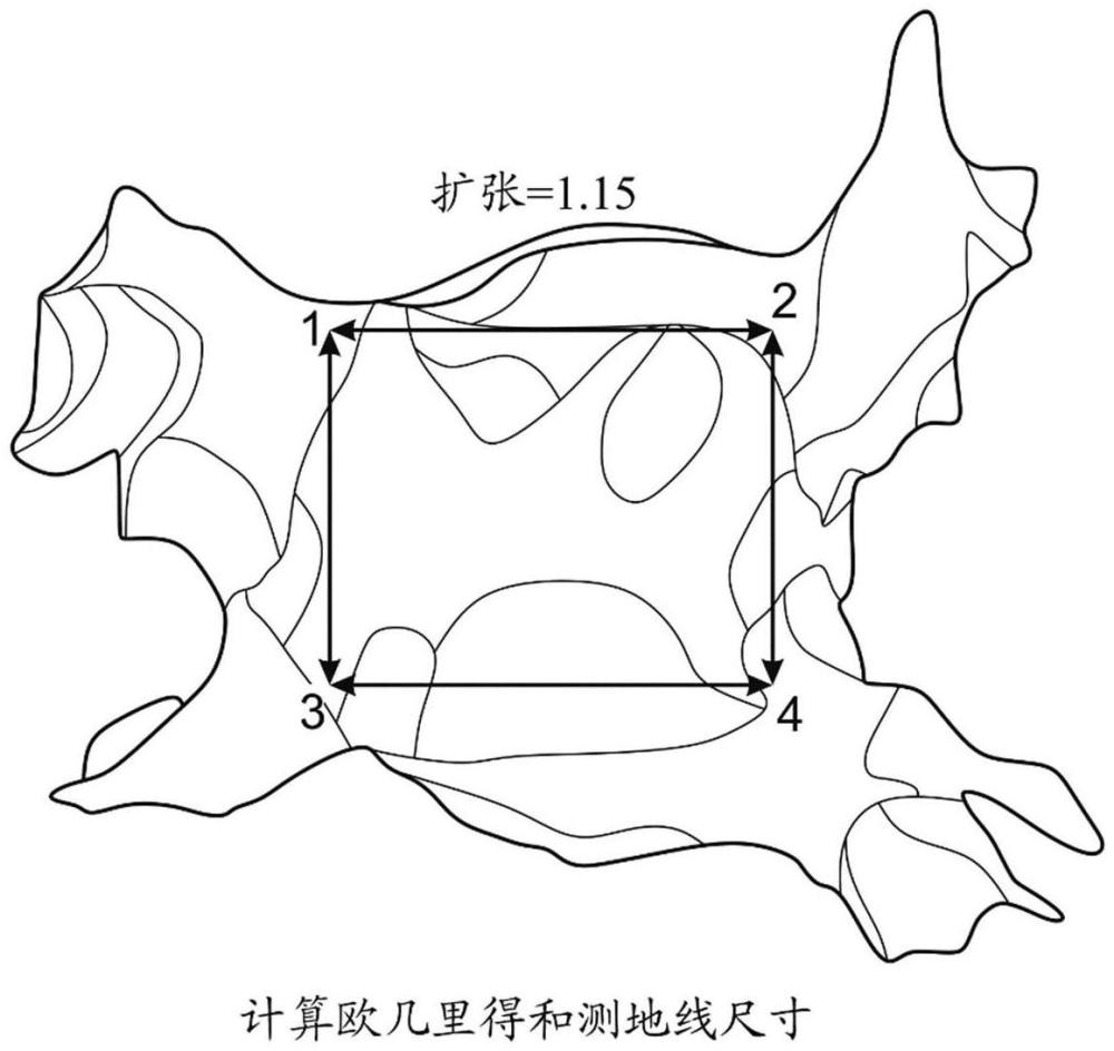 用于增強心房纖顫治療的計算機系統(tǒng)和方法與流程