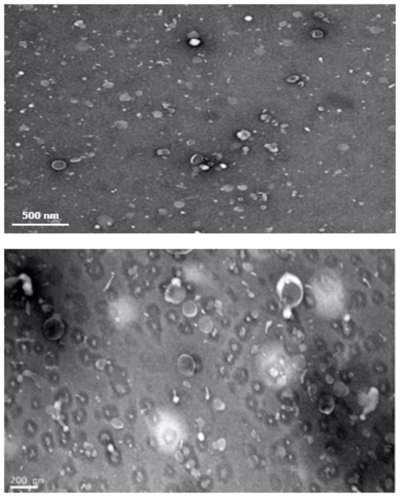一種制備外泌體的方法與應(yīng)用與流程