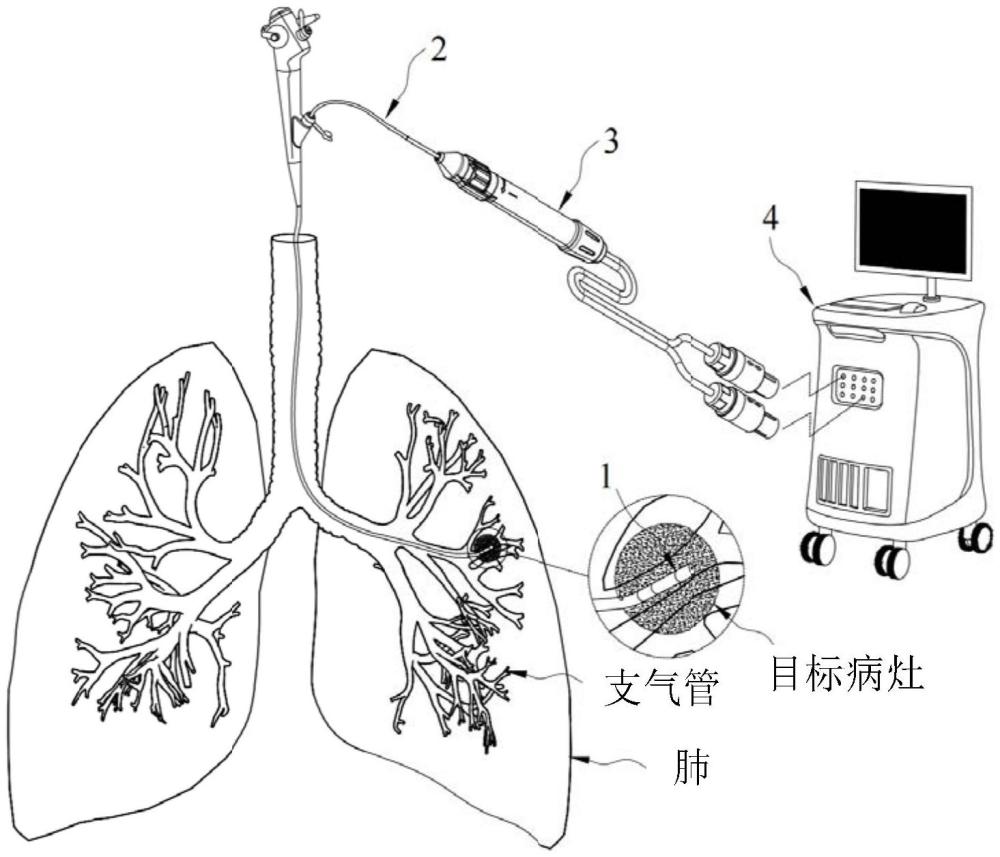 一種柔性脈沖能量遞送裝置和一種介入式脈沖消融方法與流程