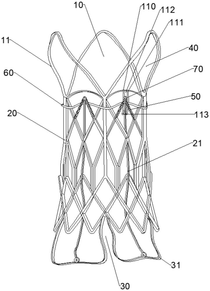一种主动脉瓣膜支架
