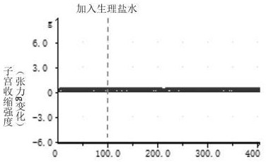 一種用于治療痛經(jīng)的皮膚外用制劑及其制備方法和應(yīng)用與流程