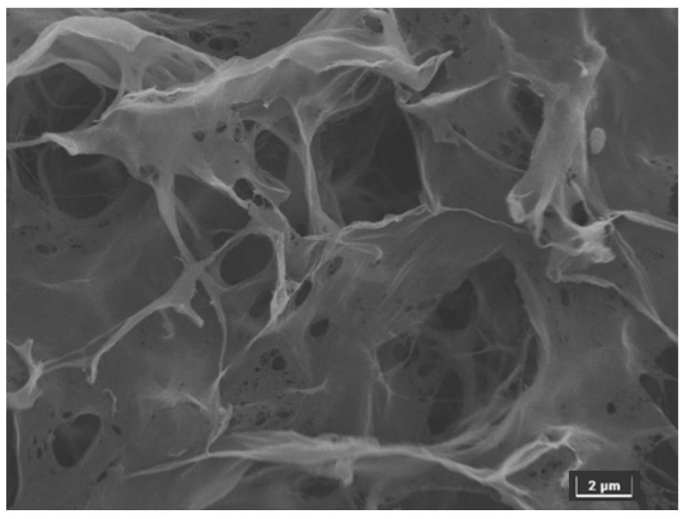 一種黃精多糖殼聚糖復(fù)合凝膠及其制備方法、生物敷料和藥品