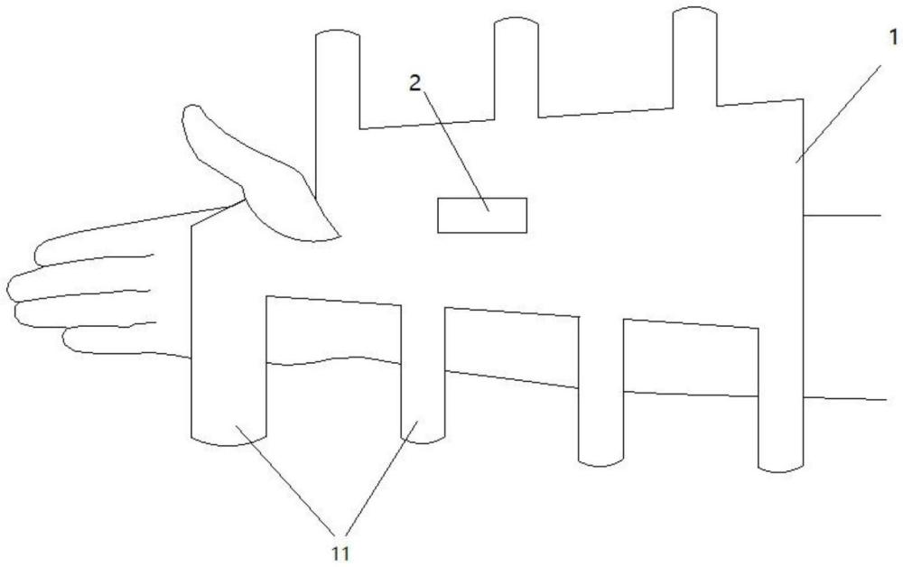 一種帶溫度監(jiān)控的橈骨骨折用高分子夾板的制作方法