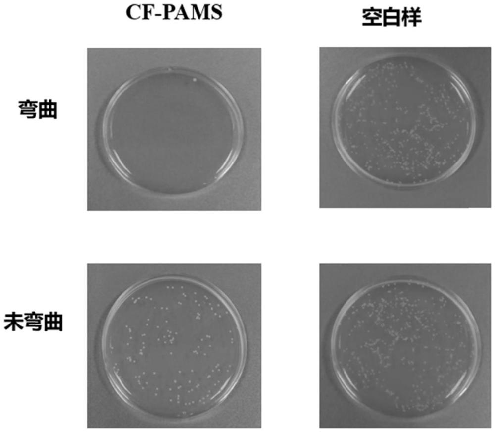 壓電式自殺菌棉織物基壓力傳感器的制備方法