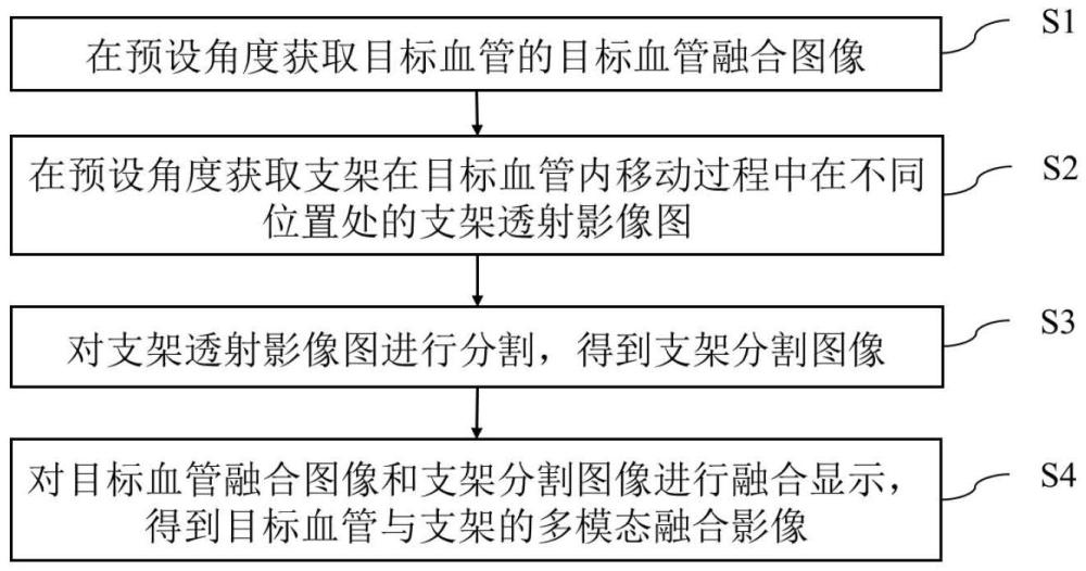 血管與血管中支架的監(jiān)測(cè)方法、裝置、設(shè)備及存儲(chǔ)介質(zhì)