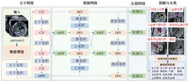 一種基于多任務(wù)的胎兒心臟標準切面檢測方法