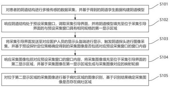 電子陰道鏡圖像采集方法及裝置