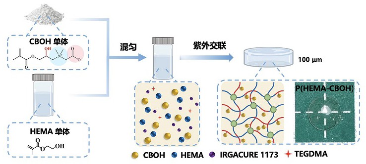 一種抗青光眼濾過術后瘢痕化反應的水凝膠及其制備方法和應用