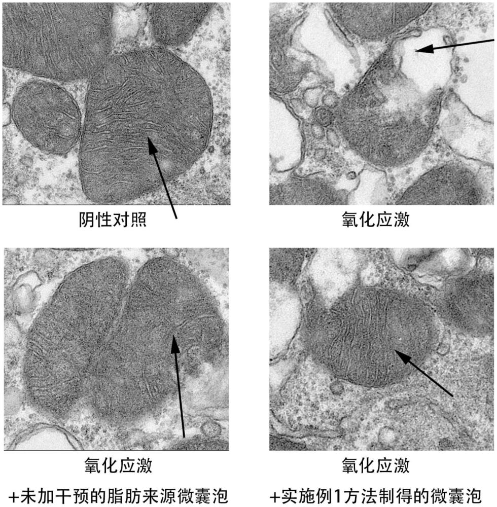 微囊泡及其制備方法和在心肌損傷修復中的應用