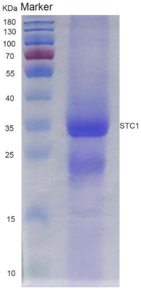 STC-1重組蛋白在制備治療心肌梗死藥物中的應用
