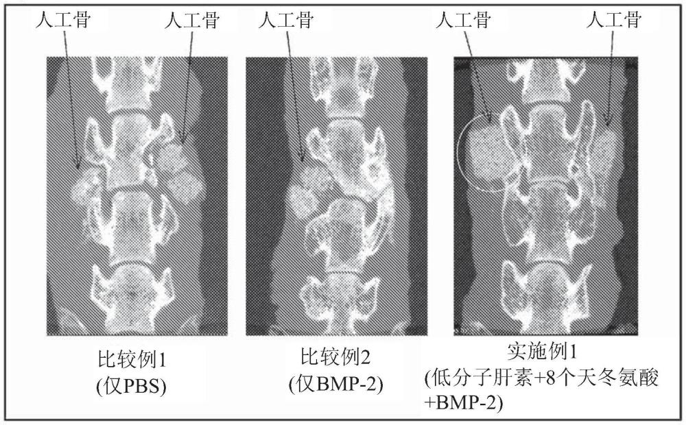 糖鏈復合體、藥物載體和藥物遞送系統