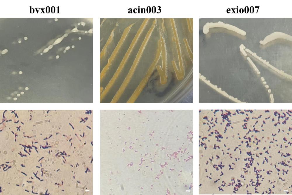 貝萊斯芽孢桿菌bvx001、復(fù)合微生物菌劑和應(yīng)用