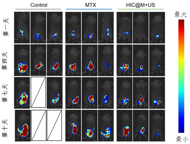 一種HIC@M納米粒子及其制備方法、應用和藥物