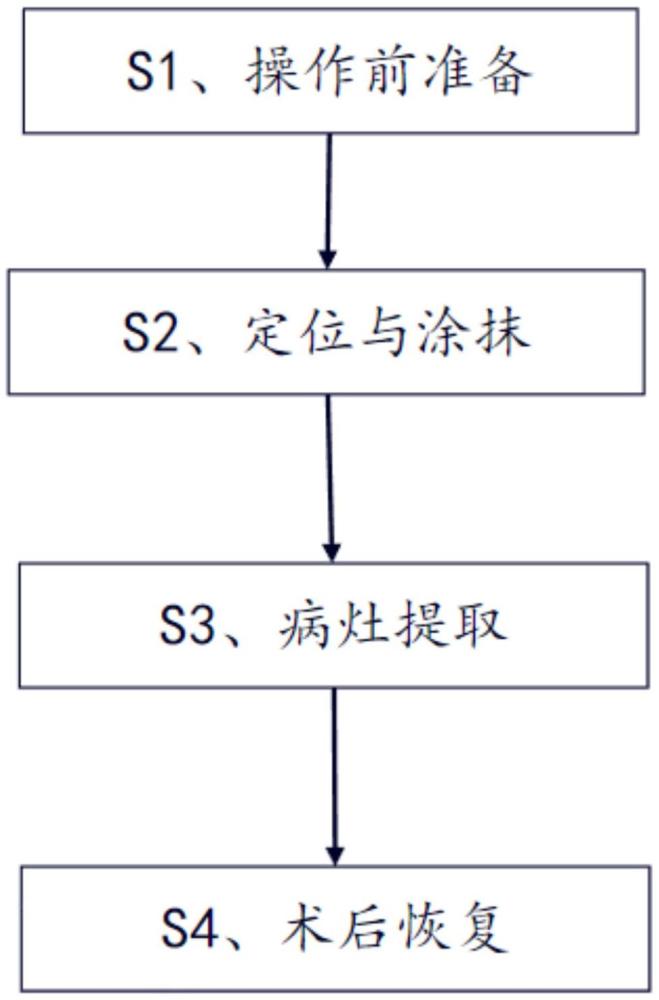 一種治療扁平疣的方法與流程
